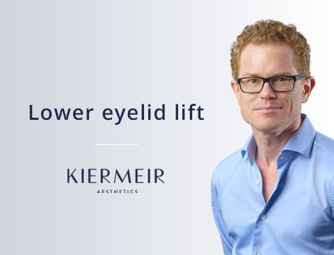 Lower Eyelid Lift in Bern by Dr. Kiermeir 