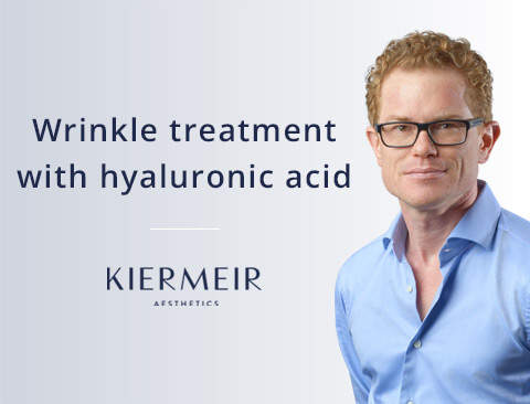 Wrinkle Treatment with Hyaluronic Acid in Bern by Dr. Kiermeir 