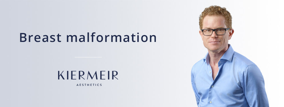 Breast Malformation in Bern by Dr. Kiermeir 