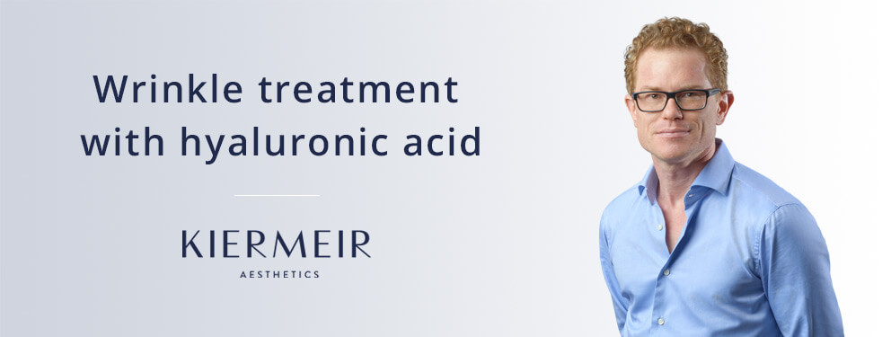 Wrinkle Treatment with Hyaluronic Acid in Bern by Dr. Kiermeir 