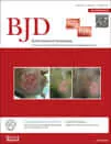 British Journal of Dermatology - Publikationen in Fachzeitschriften von Facharzt Dr. Kiermeir 